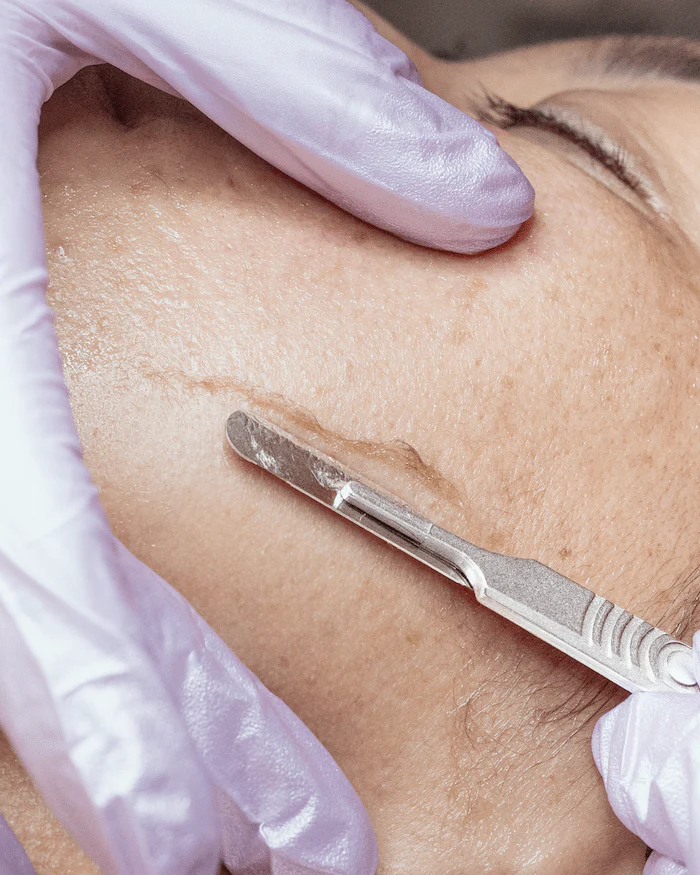 Ways to Get Rid Of Uneven Skin Texture - Joanna Vargas