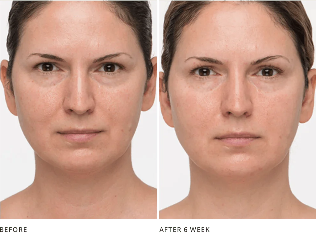 Your Eyes Look Refreshed, Less Hooded - Joanna Vargas